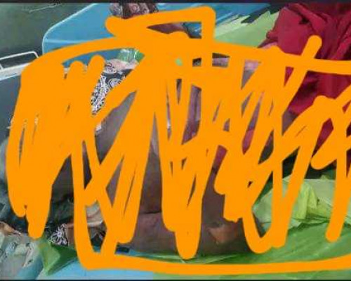 Diduga Dibakar, Pria Ini Kritis di RSUD Masohi