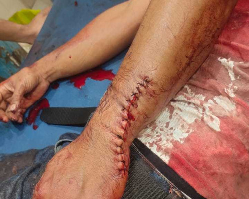 Melerai Perkelahian, PNS Ini Malah Dibacok