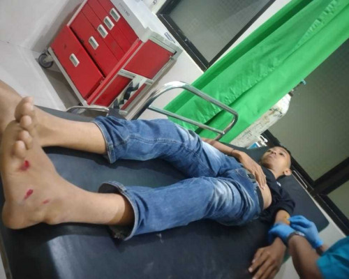 Tabrakan Setelah Motor Pria Ini Menyenggol Bak Truk