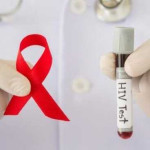 Ribuan Orang di Maluku Tertular HIV AIDS