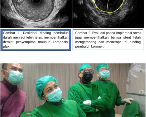 Meneropong Dinding Pembuluh Koroner dengan Pencitraan Intra Koroner