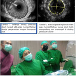 Meneropong Dinding Pembuluh Koroner dengan Pencitraan Intra Koroner
