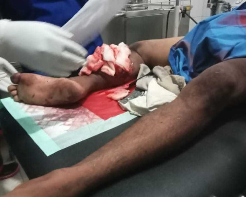 Polisi Periksa Karyawan PT SIM, Pelaku Penganiaya Warga Pelita Jaya