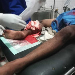 Polisi Periksa Karyawan PT SIM, Pelaku Penganiaya Warga Pelita Jaya