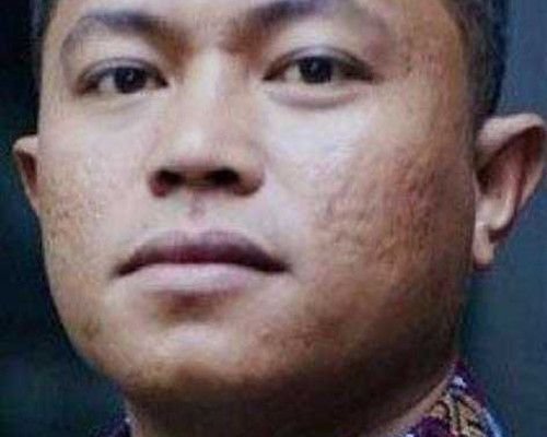 Apdesi Tator Soroti Pj Gubernur Sulsel Minta Dana Desa untuk Budidaya Pisang