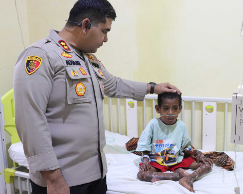 Jenguk Anak Penderita Gizi Buruk,Kapolres SBT Salurkan Bantuan