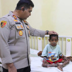 Jenguk Anak Penderita Gizi Buruk,Kapolres SBT Salurkan Bantuan